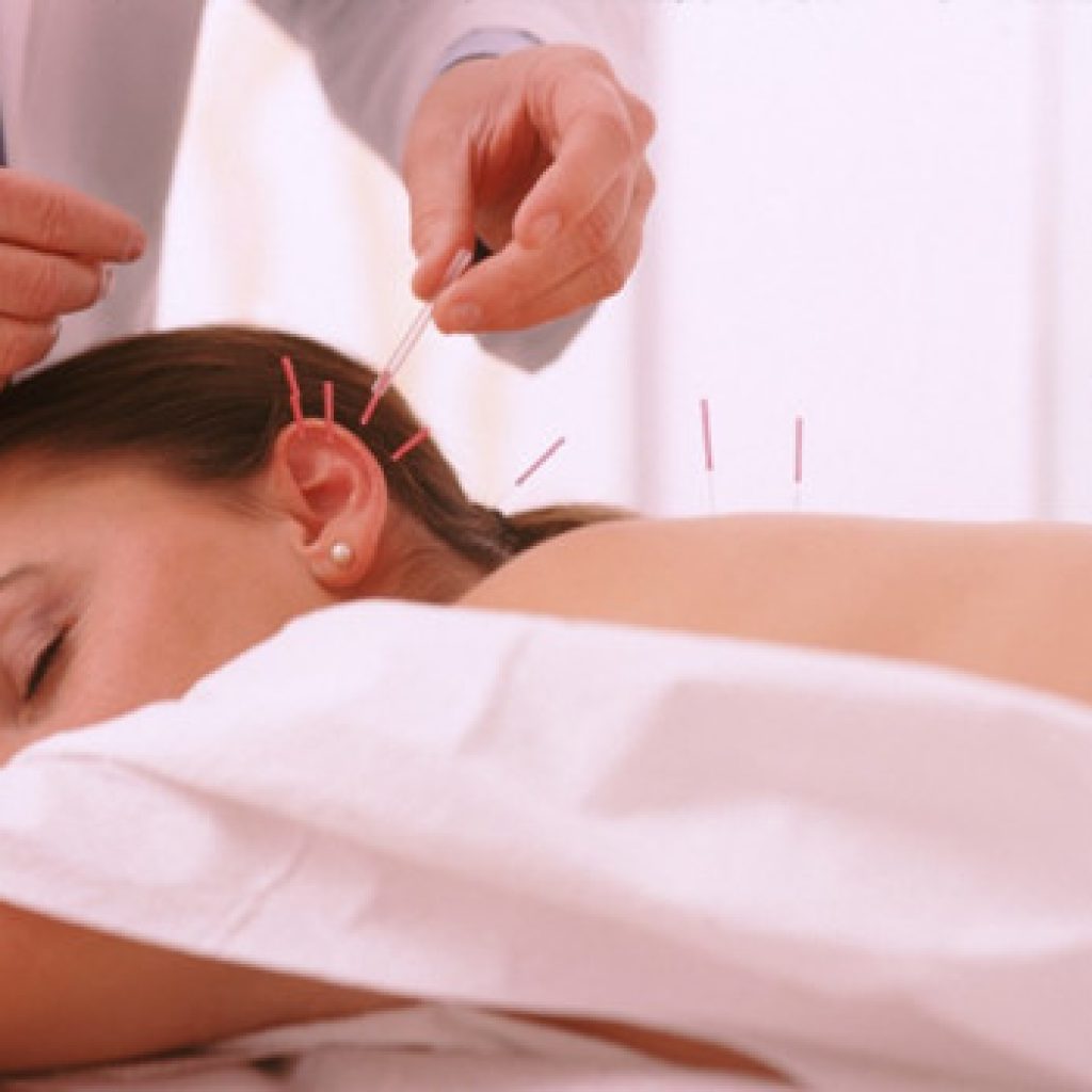  Что такое рефлексотерапия?