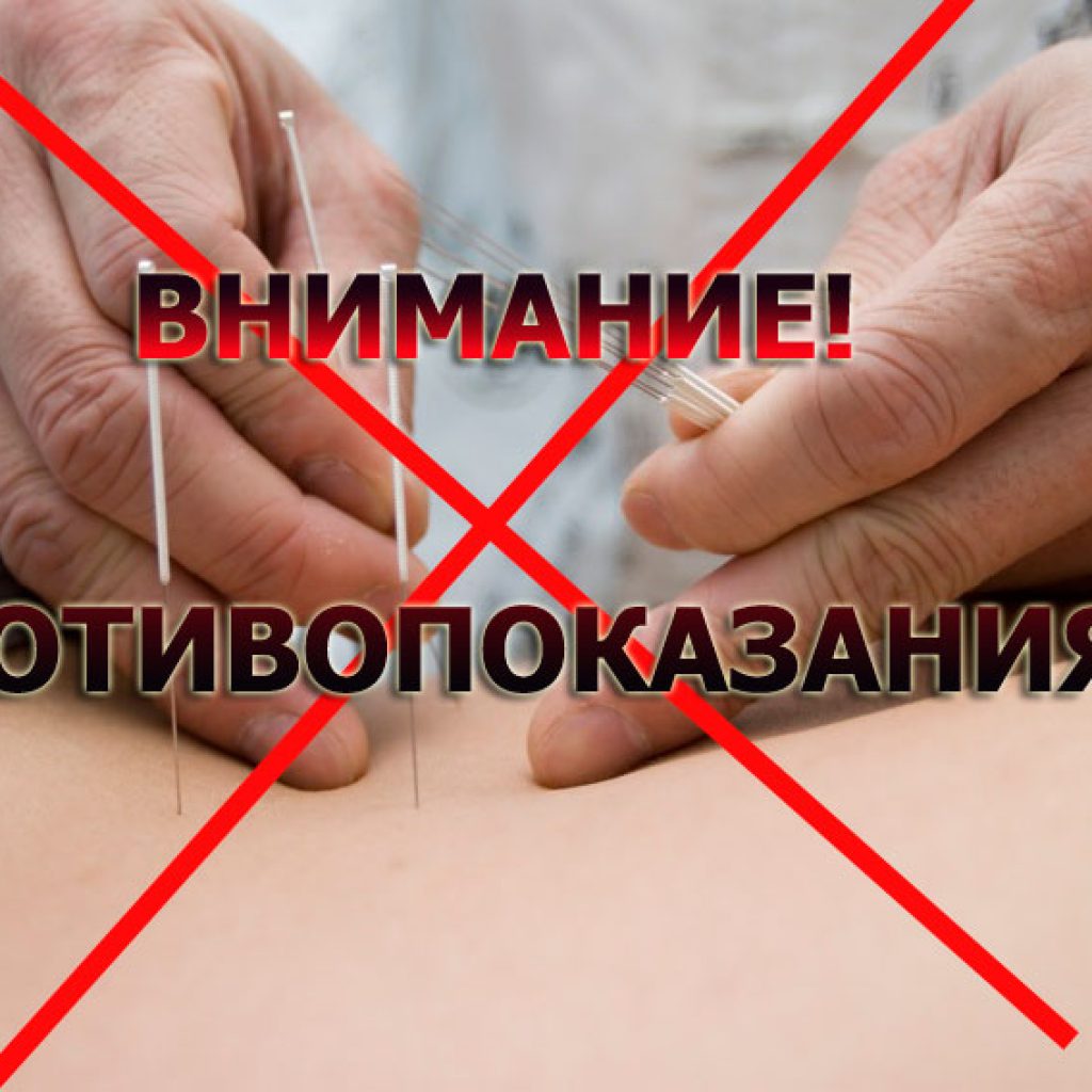  Абсолютные противопоказания к проведению акупунктуры