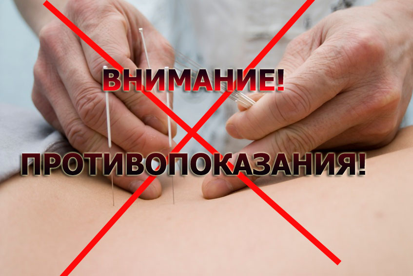 Абсолютные противопоказания к проведению акупунктуры